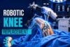 Robotic Knee Replacement Surgery: Procedure, Benefits, Risks, and Recovery - Post Thumbnail
